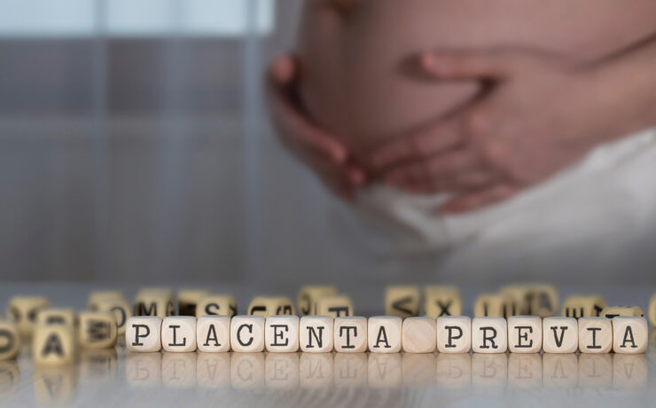 Placenta Praevia